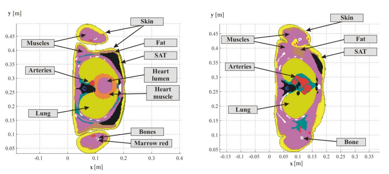 Two cross-sections on heart level. Shifted each other by 40 millimetres